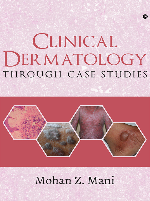 Title details for Clinical Dermatology through Case Studies by Mohan Z. Mani - Available